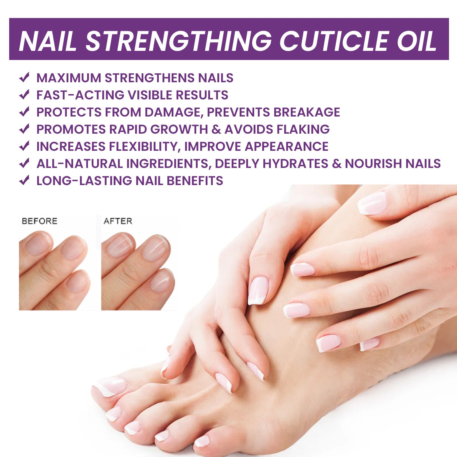 Nail Strengthening Cuticle Oil Repair Onychomycosis