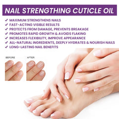 Nail Strengthening Cuticle Oil Repair Onychomycosis