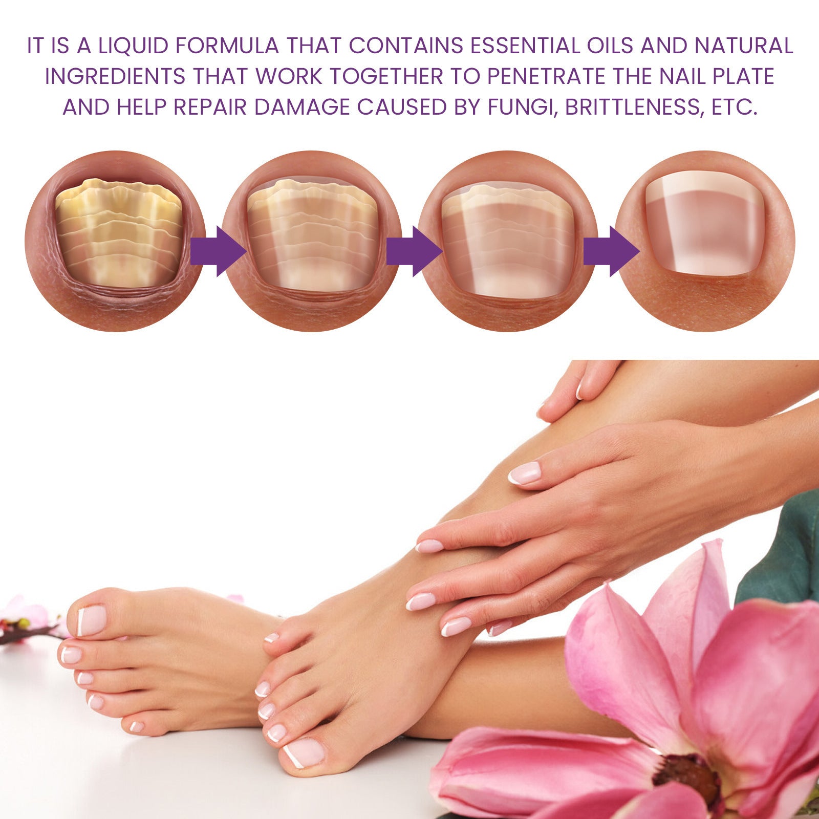 Nail Strengthening Cuticle Oil Repair Onychomycosis