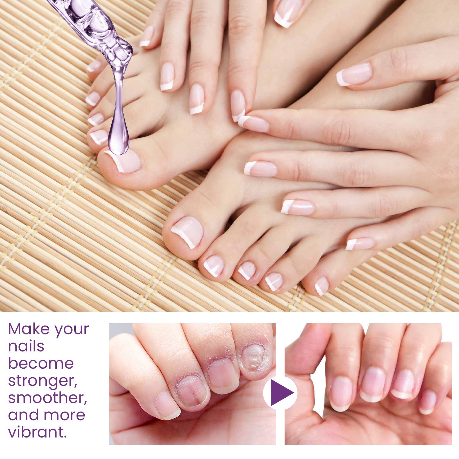 Nail Strengthening Cuticle Oil Repair Onychomycosis